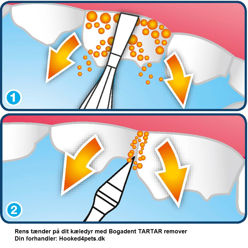 Bogadent Tartar Remover Til Plak og 2